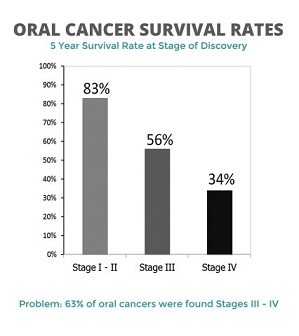 oral cancer survival rates