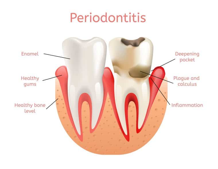 periodontal dentist corpus
